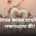 দাঁতের ক্ষয়ের প্রাথমিক লক্ষণগুলো কী?