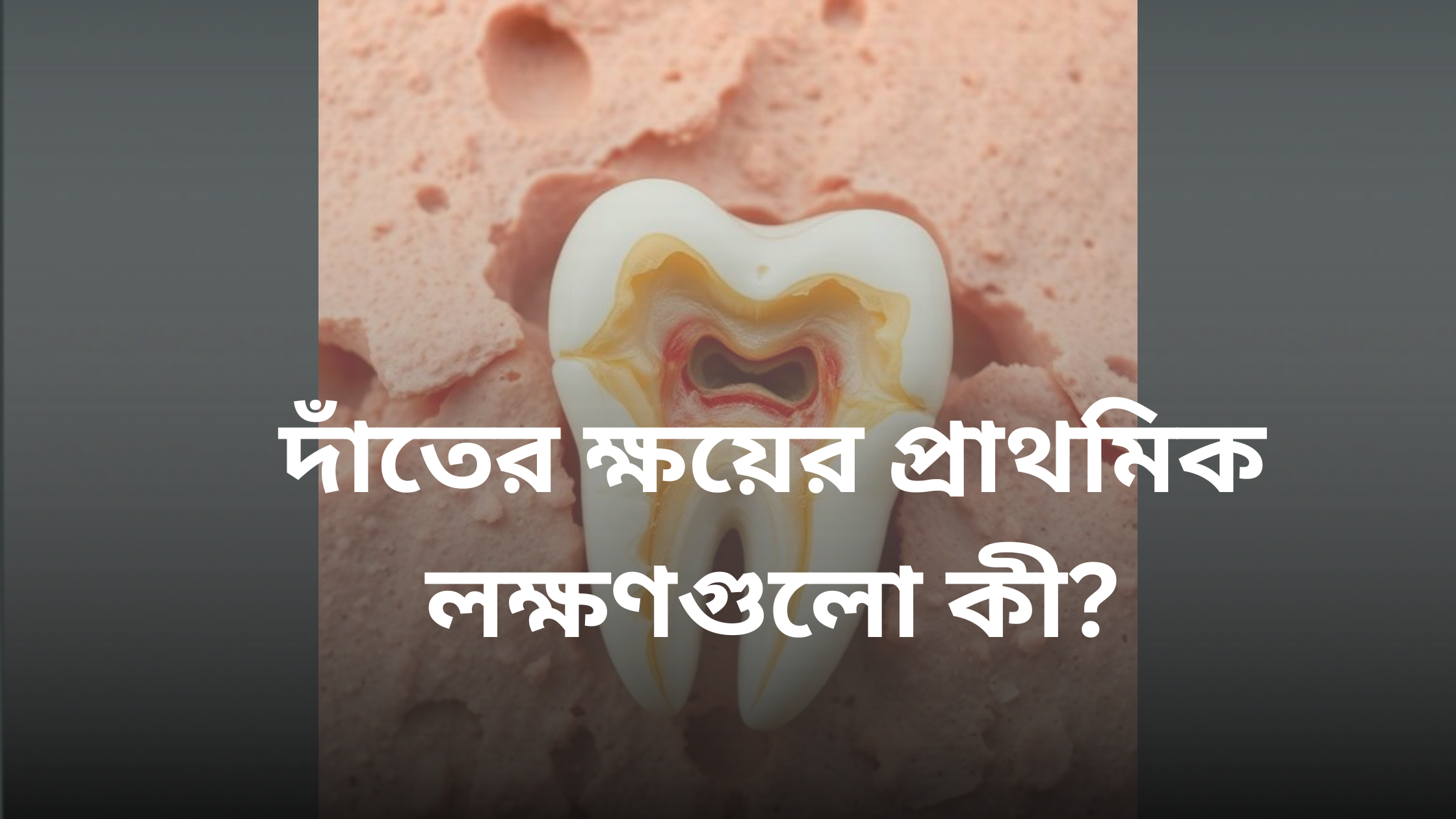 দাঁতের ক্ষয়ের প্রাথমিক লক্ষণগুলো কী?