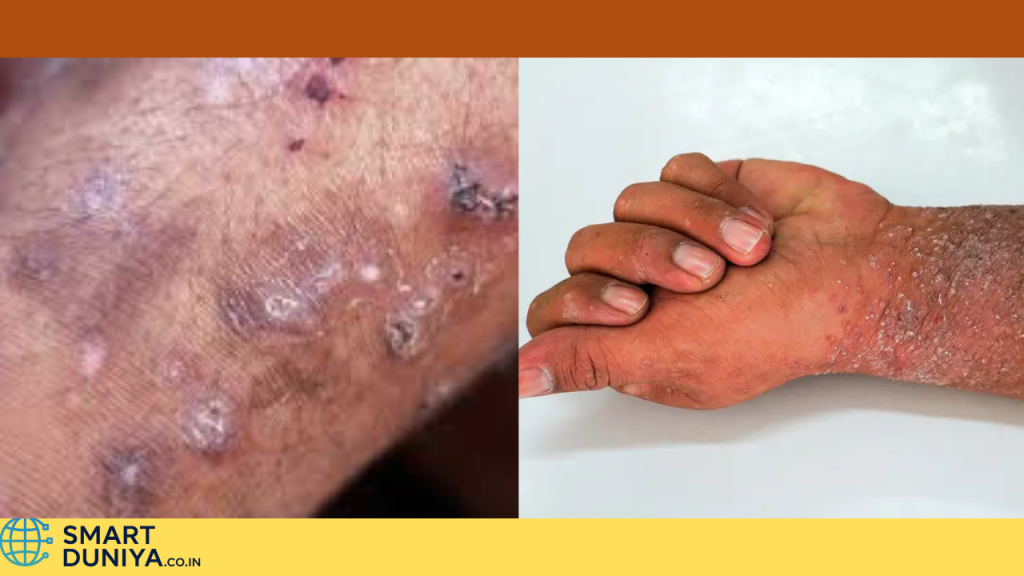 itching problem