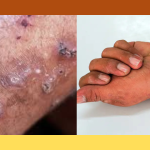 itching problem