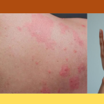 কখনোই চর্মরোগ হবে না — নিয়ম মেনে চলুন