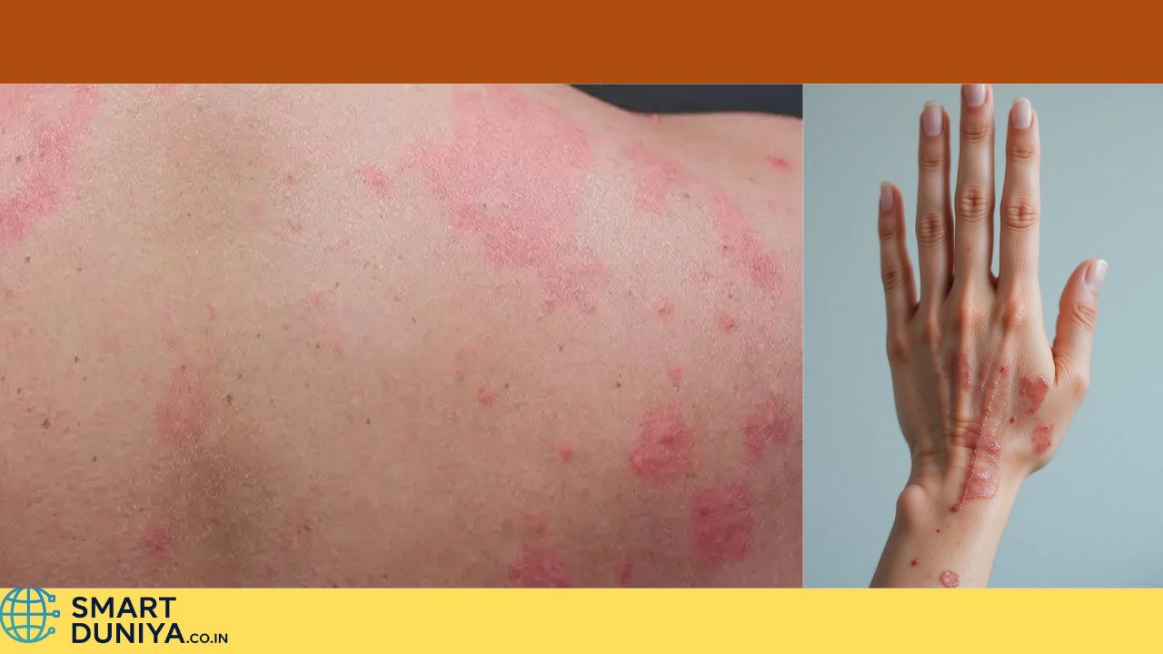 কখনোই চর্মরোগ হবে না — নিয়ম মেনে চলুন