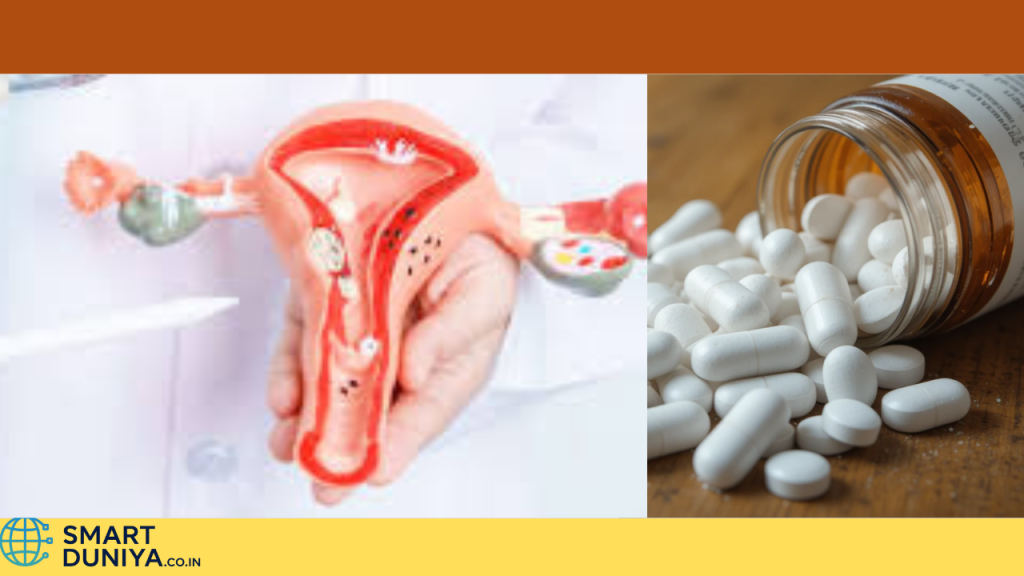 what-is-pcos-symptoms-and-treatment-bengali