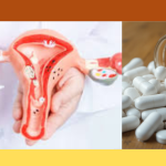 what-is-pcos-symptoms-and-treatment-bengali