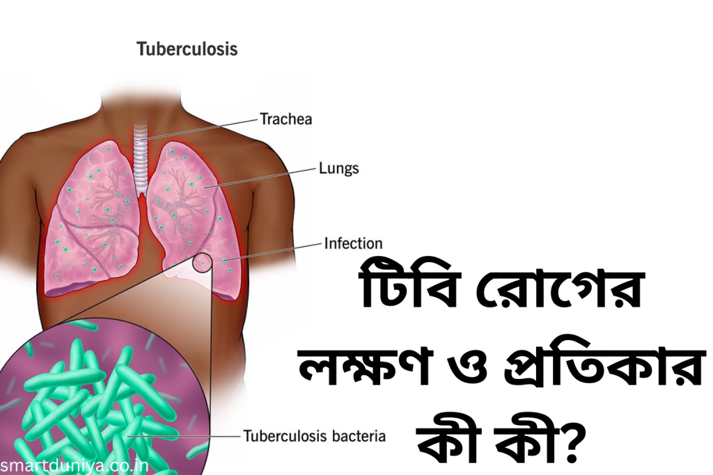 টিবি রোগের লক্ষণ ও প্রতিকার কী কী?