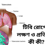 টিবি রোগের লক্ষণ ও প্রতিকার কী কী?